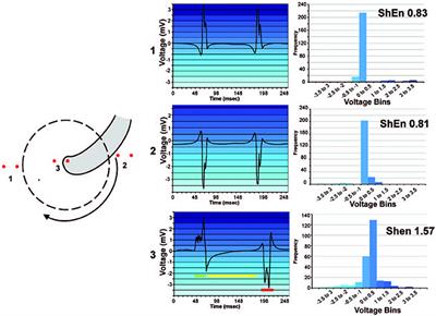 Information Theory and Atrial Fibrillation (AF): A Review